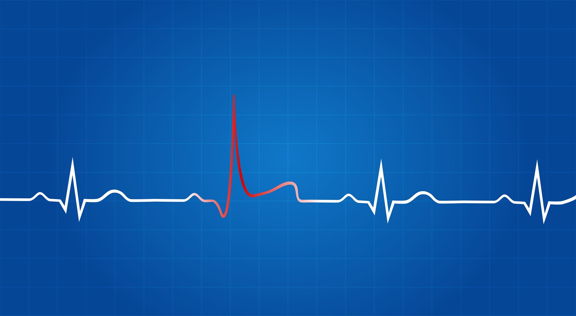 Heart line graph